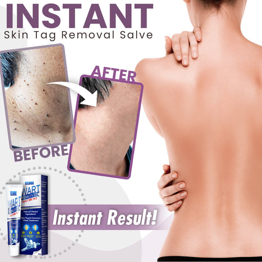 Instant Skin Tag Removal Salve