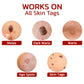 GFOUK™ WipeOff Tags And Moles Remover